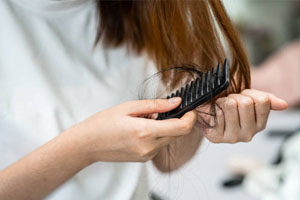 How Can I Stop Hair Loss Fast? Tips for Rapid Hair Loss Prevention